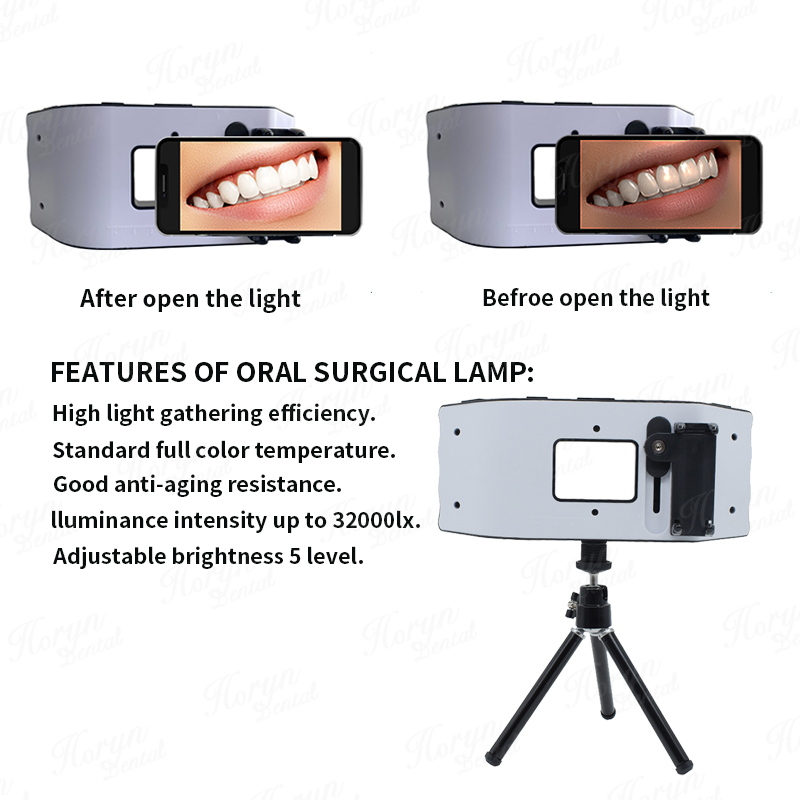 Lampu kilat gigi, peralatan fo - Photography Lighting Led ulasan dan harga
